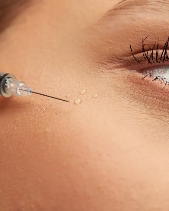 Augen-Mesotherapie mit Mikroinjektionen bei AS Clinic Berlin