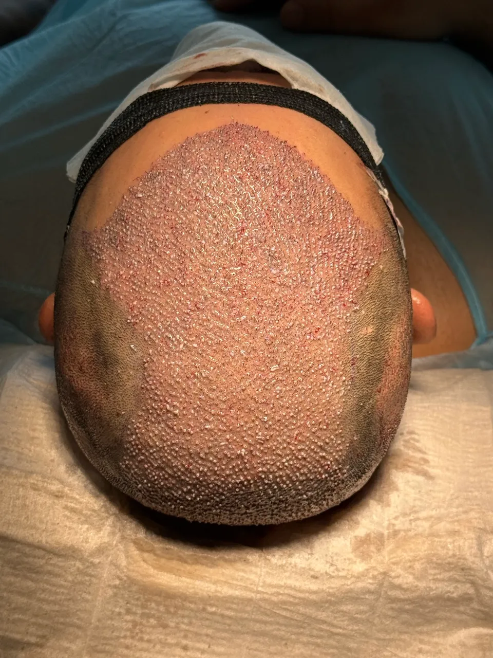 Der Transplantationssaal