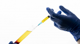 hands-holding-syringe-prp-vial