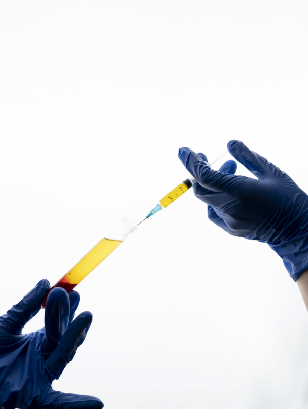 hands-holding-syringe-prp-vial