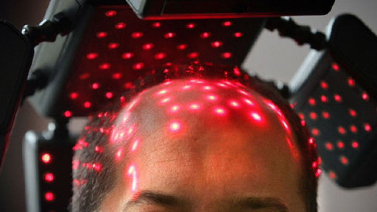 Lasertherapie Haarausfall in berlin germany